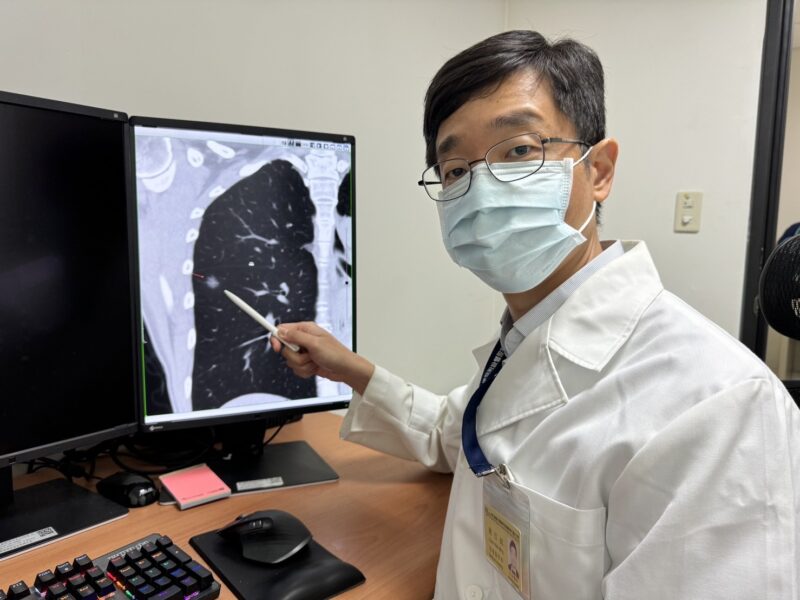 肺癌無聲無息　陳信銘醫師建議及早篩檢