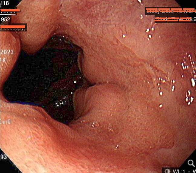 忍忍就沒事的輕微腹痛腹瀉 恐是肚子著涼 丁楷庭醫師：冬季是腸胃病高峰期 腹部保暖很重要