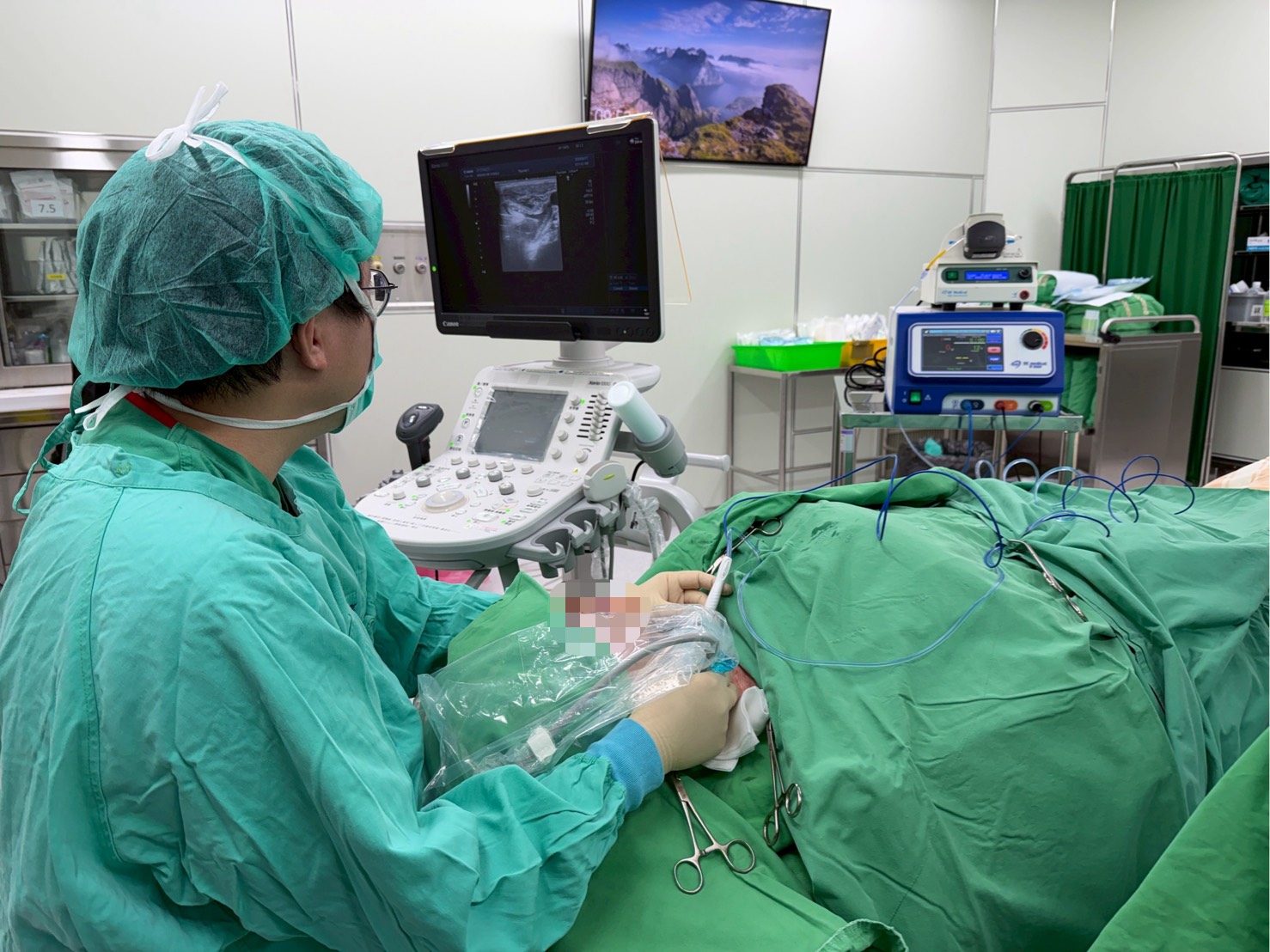 高醫岡山醫院：良性甲狀腺結節不一定要開刀　消融治療成新選擇